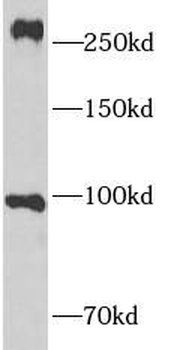 NOTCH3 Rabbit Polyclonal Antibody