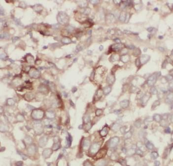 NOTCH3 Rabbit Polyclonal Antibody