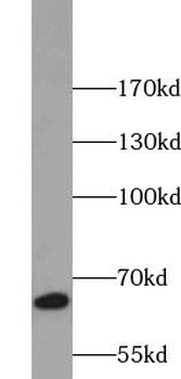 NCF2 Rabbit Polyclonal Antibody