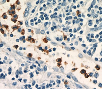 NCF2 Rabbit Polyclonal Antibody