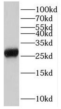 NPAS3 Rabbit Polyclonal Antibody