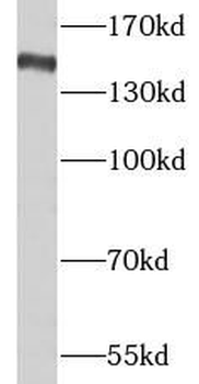 NPC1 Antibody
