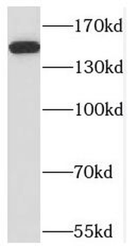 NPHP3 Rabbit Polyclonal Antibody