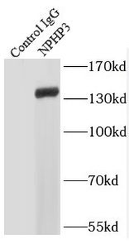 NPHP3 Rabbit Polyclonal Antibody
