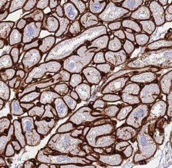 NPHP3 Rabbit Polyclonal Antibody