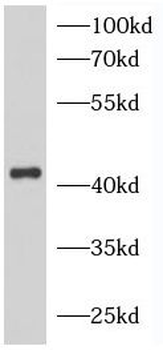 NPHS2 Rabbit Polyclonal Antibody