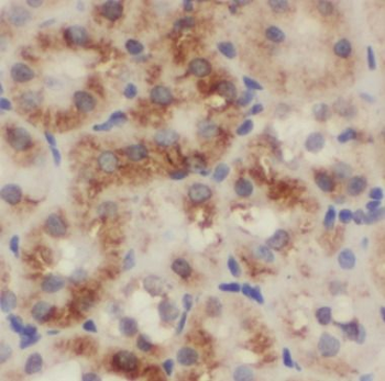 NPHS2 Rabbit Polyclonal Antibody