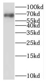 NPLOC4 Rabbit Polyclonal Antibody