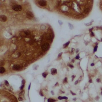 NPLOC4 Rabbit Polyclonal Antibody