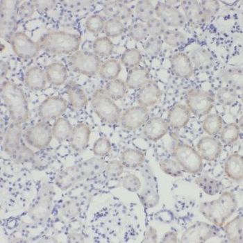 NPR3 Rabbit Polyclonal Antibody