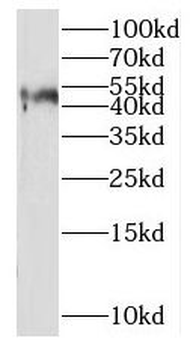 NPTX2 Antibody