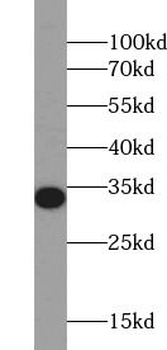 NQO1 Rabbit Polyclonal Antibody