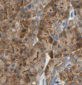NQO1 Rabbit Polyclonal Antibody