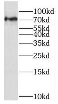 NR1D2 Rabbit Polyclonal Antibody