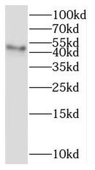 NR1I3 Rabbit Polyclonal Antibody
