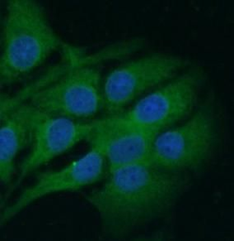 GRIN2B Rabbit Polyclonal Antibody