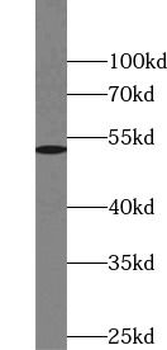 NR5A1 Rabbit Polyclonal Antibody