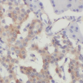 NRAS Rabbit Polyclonal Antibody