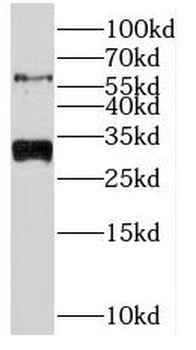 NRBP2 Rabbit Polyclonal Antibody