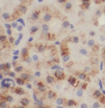 NRDC Rabbit Polyclonal Antibody