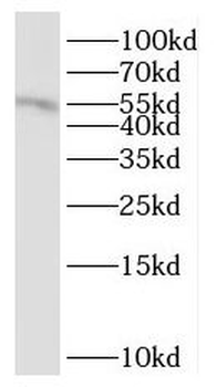 HMGN5 Rabbit Polyclonal Antibody