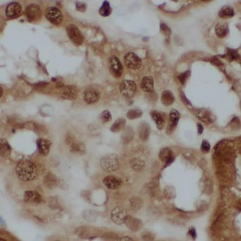 HMGN5 Rabbit Polyclonal Antibody