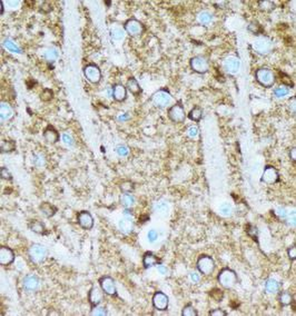 ENO2 Rabbit Polyclonal Antibody