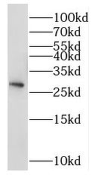 NSMCE2 Antibody