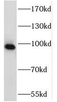 NSUN2 Antibody