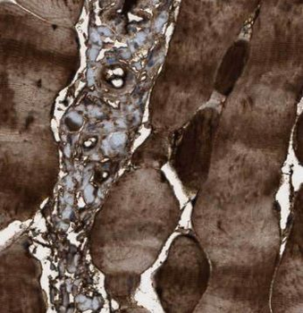 NT5C Rabbit Polyclonal Antibody
