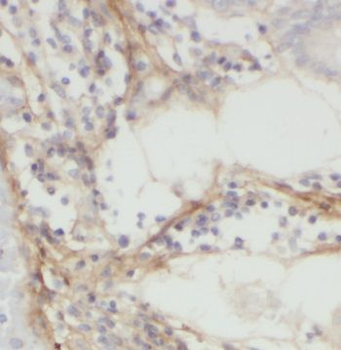 NT5C3A Rabbit Polyclonal Antibody