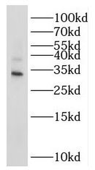 NTHL1 Rabbit Polyclonal Antibody