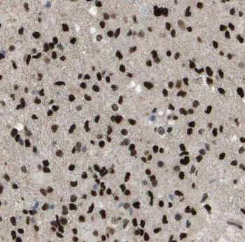 NTHL1 Rabbit Polyclonal Antibody