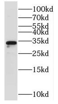 NTHL1 Rabbit Polyclonal Antibody