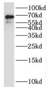 NTM Rabbit Polyclonal Antibody