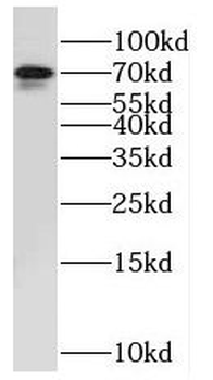 NUAK2 Rabbit Polyclonal Antibody