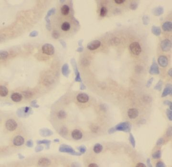 NUAK2 Rabbit Polyclonal Antibody