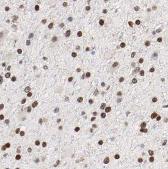 NUCKS1 Antibody