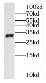 PNP Rabbit Polyclonal Antibody
