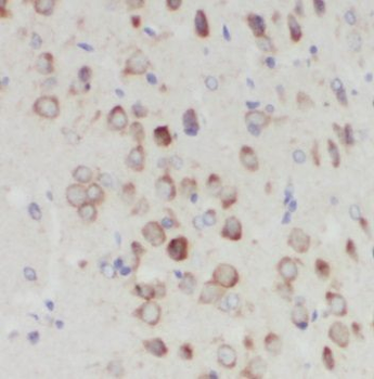 NUDCD3 Rabbit Polyclonal Antibody