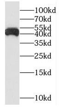 NUDT19 Rabbit Polyclonal Antibody