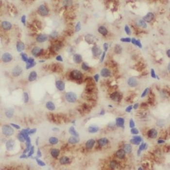 NUDT19 Rabbit Polyclonal Antibody