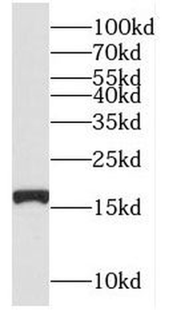 NUDT2 Rabbit Polyclonal Antibody