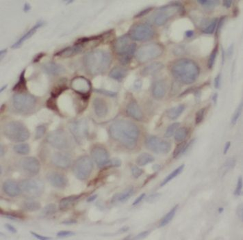 NUDT2 Rabbit Polyclonal Antibody