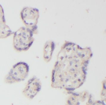 NUDT21 Antibody
