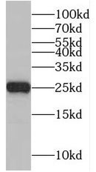 NUDT8 Rabbit Polyclonal Antibody