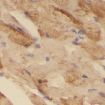 NUDT8 Rabbit Polyclonal Antibody