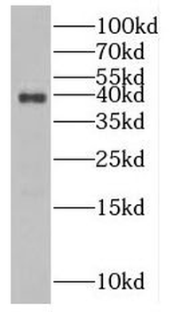 NUDT9 Rabbit Polyclonal Antibody