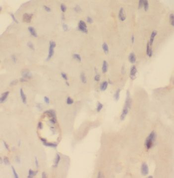 NUDT9 Rabbit Polyclonal Antibody