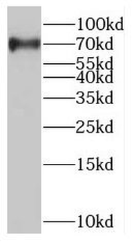 NUMB Rabbit Polyclonal Antibody
